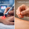 Laser Acupuncture vs Traditional Acupuncture: Which Is Right For You?